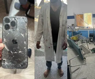 وزان.. إصابة إطار صحي بجروح بعد الاعتداء عليه من طرف أحد المرتفقين